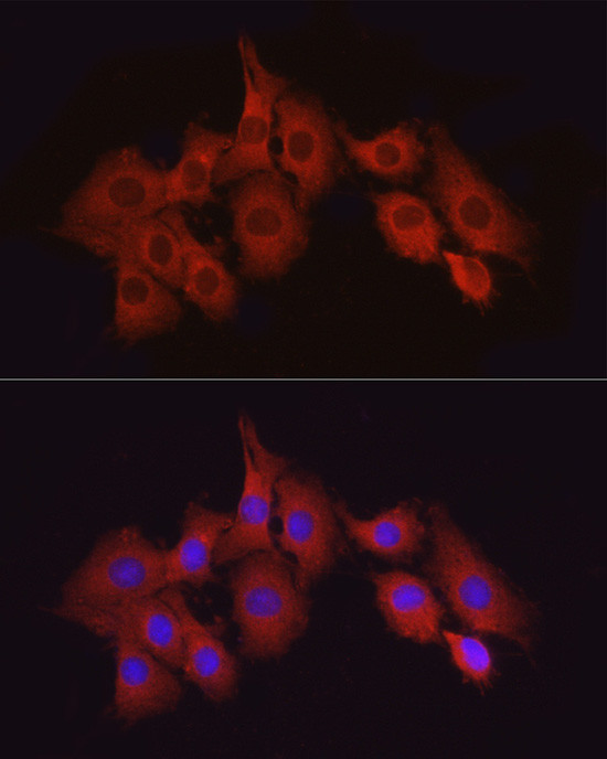 TAK1 Antibody in Immunocytochemistry (ICC/IF)