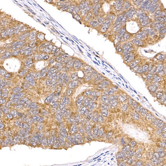 TAK1 Antibody in Immunohistochemistry (Paraffin) (IHC (P))