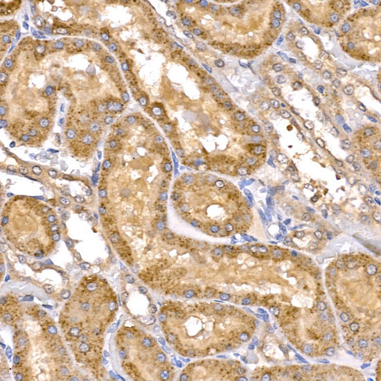 TAK1 Antibody in Immunohistochemistry (Paraffin) (IHC (P))