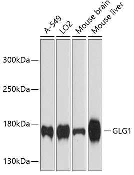 GLG1 Antibody in Western Blot (WB)