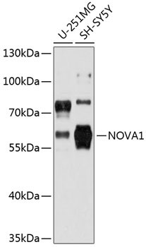 NOVA1 Antibody in Western Blot (WB)