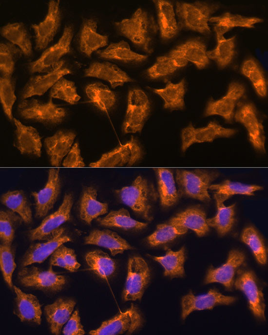 SPRR3 Antibody in Immunocytochemistry (ICC/IF)