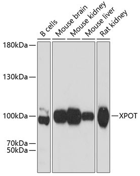 XPOT Antibody in Western Blot (WB)