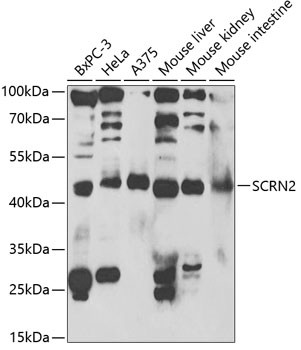 SCRN2 Antibody in Western Blot (WB)