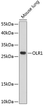 LOX-1 Antibody in Western Blot (WB)