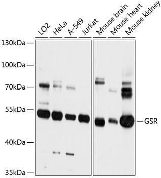 GSR Antibody in Western Blot (WB)