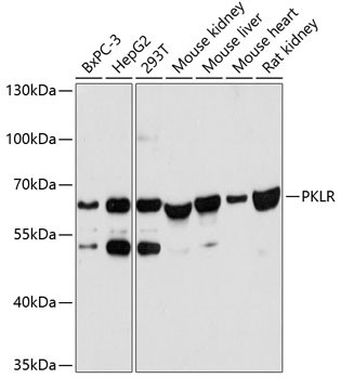 PKLR Antibody in Western Blot (WB)