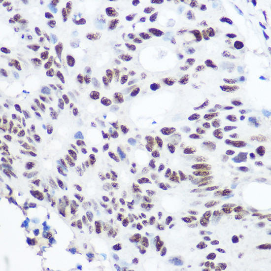 SART3 Antibody in Immunohistochemistry (Paraffin) (IHC (P))