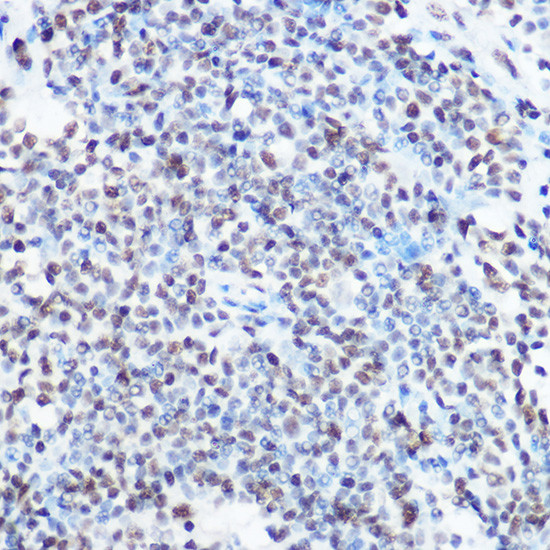 SART3 Antibody in Immunohistochemistry (Paraffin) (IHC (P))