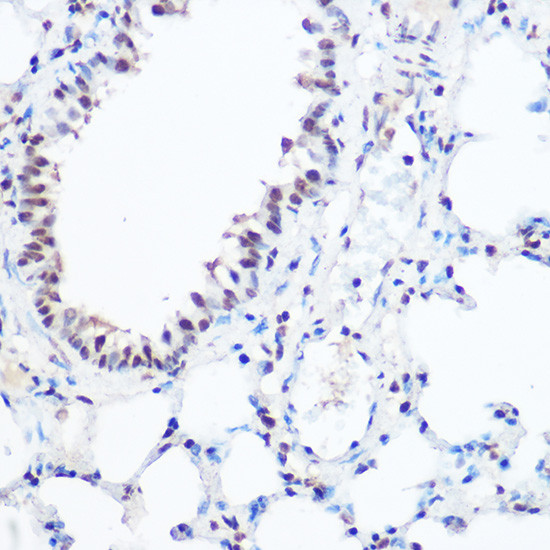 SART3 Antibody in Immunohistochemistry (Paraffin) (IHC (P))