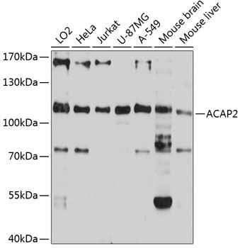 ACAP2 Antibody in Western Blot (WB)