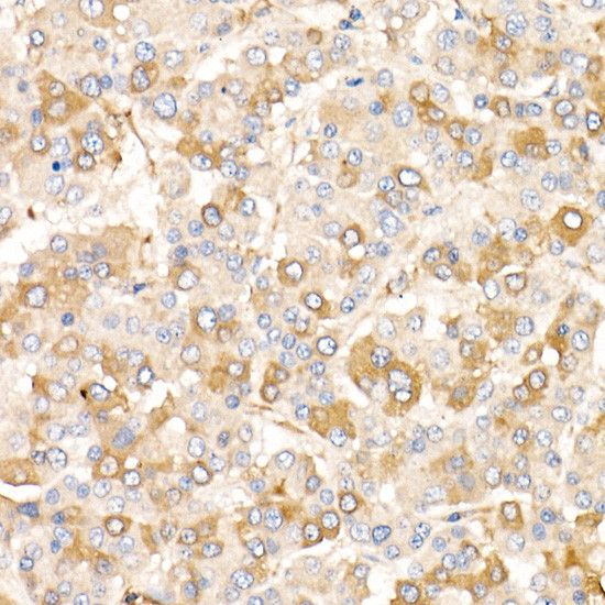 AMID Antibody in Immunohistochemistry (Paraffin) (IHC (P))