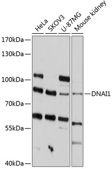 DNAI1 Antibody in Western Blot (WB)