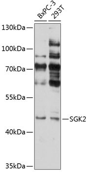 SGK2 Antibody in Western Blot (WB)