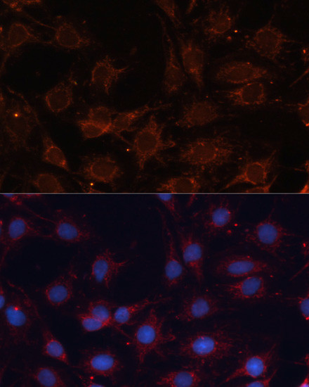 SLC25A24 Antibody in Immunocytochemistry (ICC/IF)