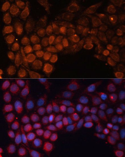 SLC25A24 Antibody in Immunocytochemistry (ICC/IF)