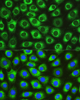 DNAJC10 Antibody in Immunocytochemistry (ICC/IF)