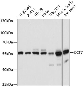 TCP1 eta Antibody in Western Blot (WB)