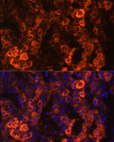 BHMT Antibody in Immunocytochemistry (ICC/IF)