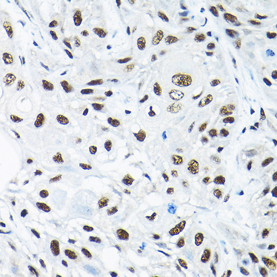 SNRPA1 Antibody in Immunohistochemistry (Paraffin) (IHC (P))