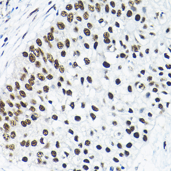 SNRPA1 Antibody in Immunohistochemistry (Paraffin) (IHC (P))