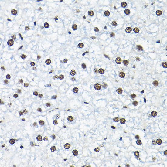 SNRPA1 Antibody in Immunohistochemistry (Paraffin) (IHC (P))