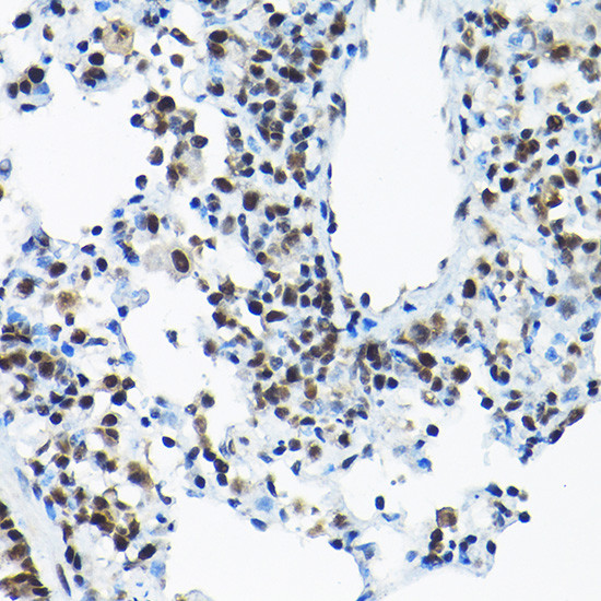 SNRPA1 Antibody in Immunohistochemistry (Paraffin) (IHC (P))