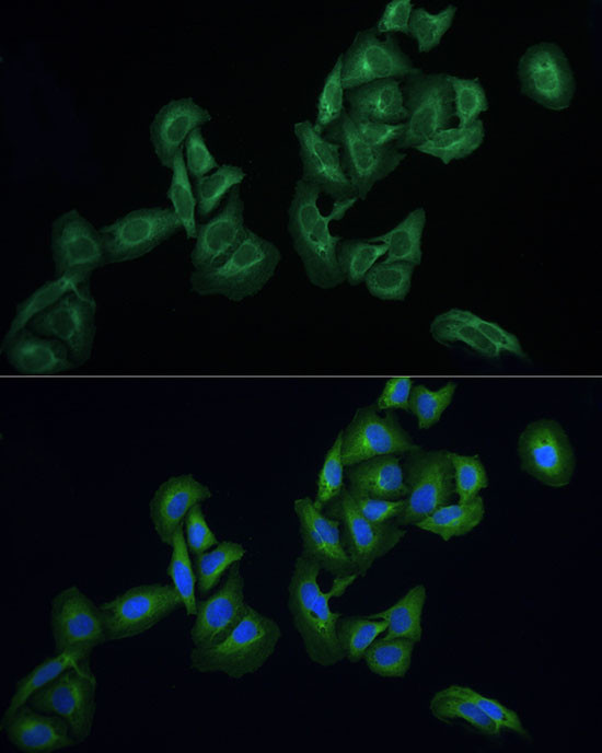 AGTRAP Antibody in Immunocytochemistry (ICC/IF)