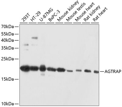 AGTRAP Antibody in Western Blot (WB)