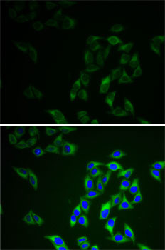 Adenylate Kinase 1 Antibody in Immunocytochemistry (ICC/IF)