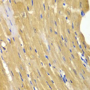 Adenylate Kinase 1 Antibody in Immunohistochemistry (Paraffin) (IHC (P))