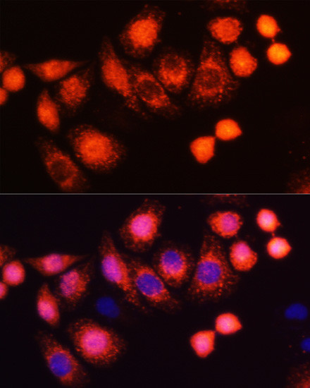 H-Ras Antibody in Immunocytochemistry (ICC/IF)