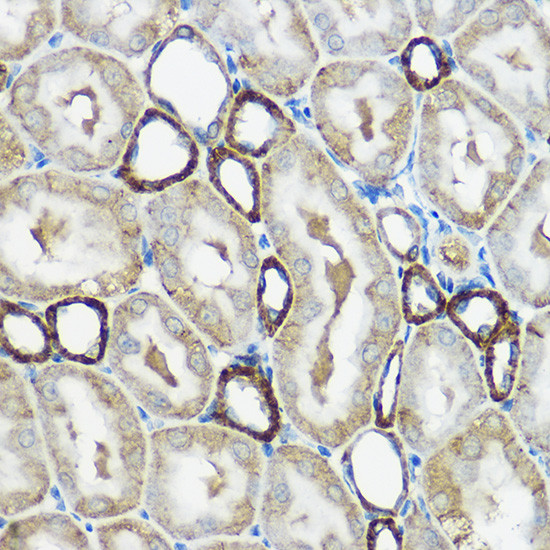 IP6K1 Antibody in Immunohistochemistry (Paraffin) (IHC (P))