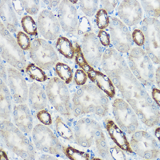 IP6K1 Antibody in Immunohistochemistry (Paraffin) (IHC (P))