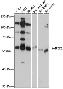 IP6K1 Antibody in Western Blot (WB)