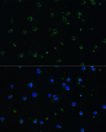 ARHGAP25 Antibody in Immunocytochemistry (ICC/IF)