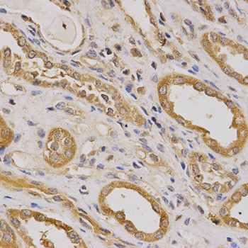 ARHGAP25 Antibody in Immunohistochemistry (Paraffin) (IHC (P))