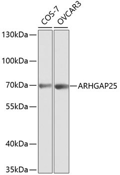 ARHGAP25 Antibody in Western Blot (WB)