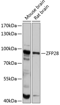 ZFP28 Antibody in Western Blot (WB)