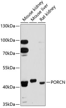 PORCN Antibody in Western Blot (WB)