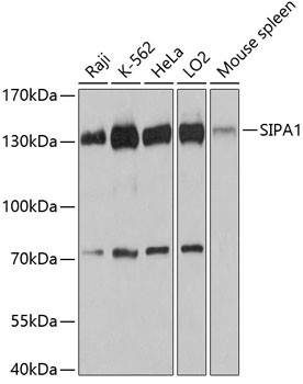 SIPA1 Antibody in Western Blot (WB)