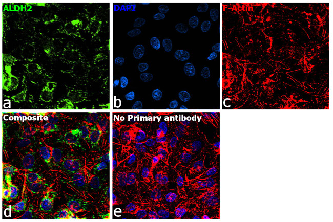 ALDH2 Antibody in Immunocytochemistry (ICC/IF)