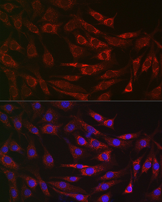 ALDH2 Antibody in Immunocytochemistry (ICC/IF)