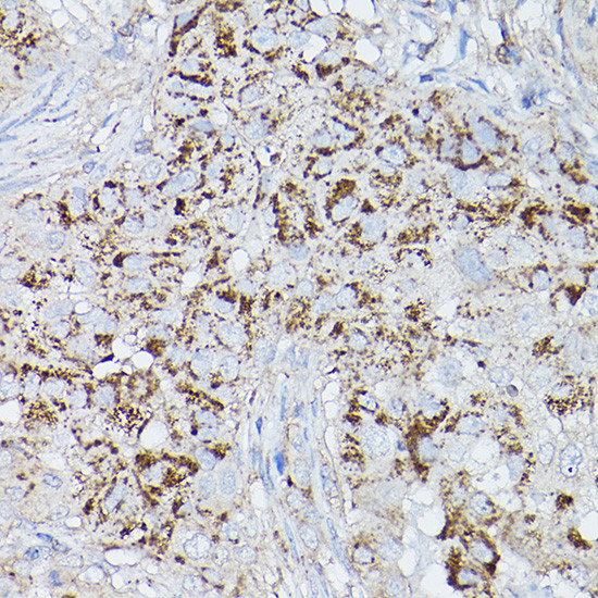 ALDH2 Antibody in Immunohistochemistry (Paraffin) (IHC (P))