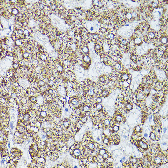 ALDH2 Antibody in Immunohistochemistry (Paraffin) (IHC (P))