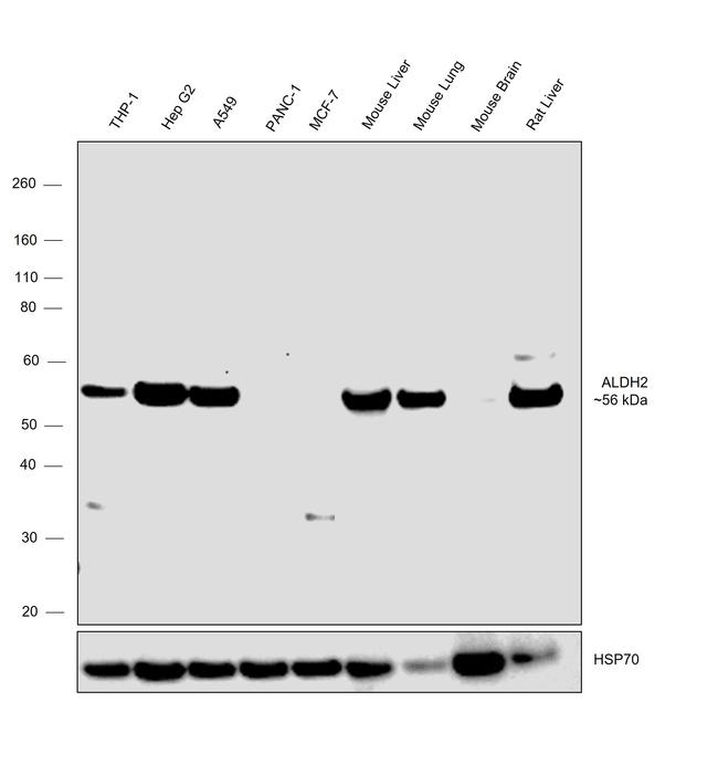 ALDH2 Antibody in Western Blot (WB)