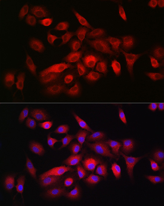 CD55 Antibody in Immunocytochemistry (ICC/IF)