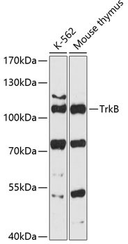 TrkB Antibody in Western Blot (WB)