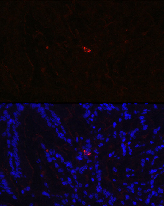 NTS Antibody in Immunohistochemistry (Paraffin) (IHC (P))