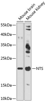 NTS Antibody in Western Blot (WB)